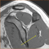 Fig. 15