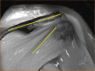 Fig. 14