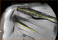 Fig. 13