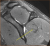 Fig. 16
