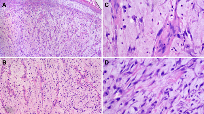 Fig. 2