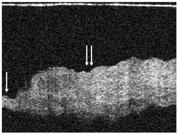 FIG. 6