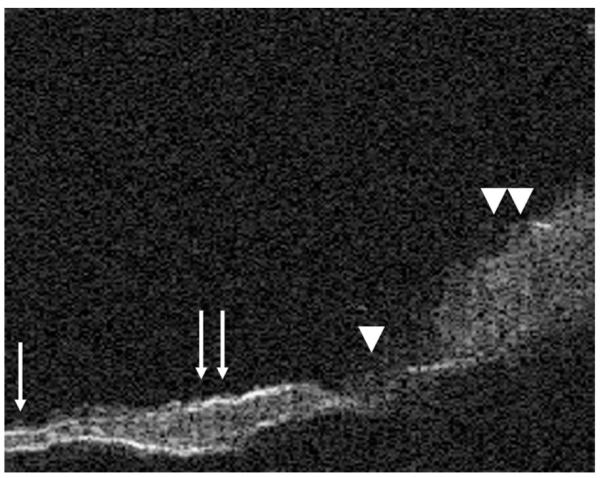 FIG. 5