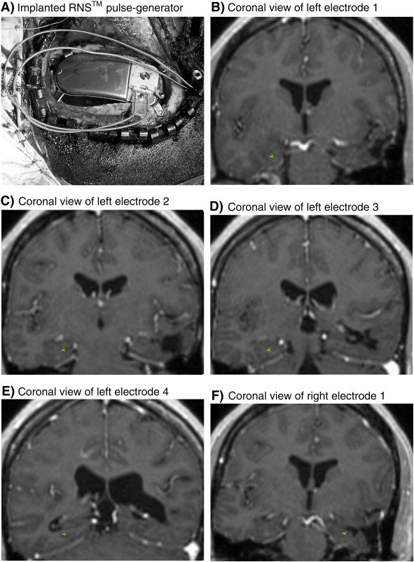 Fig. 1