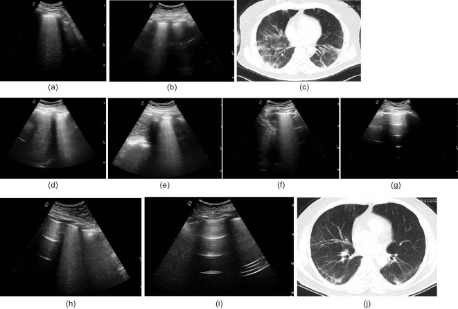 Fig. 5