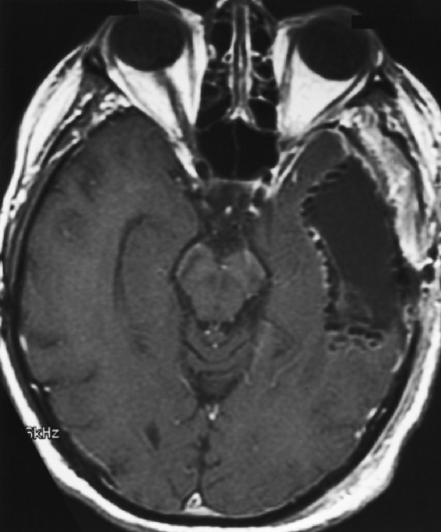 Fig. 1b