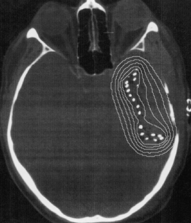 Fig. 1c