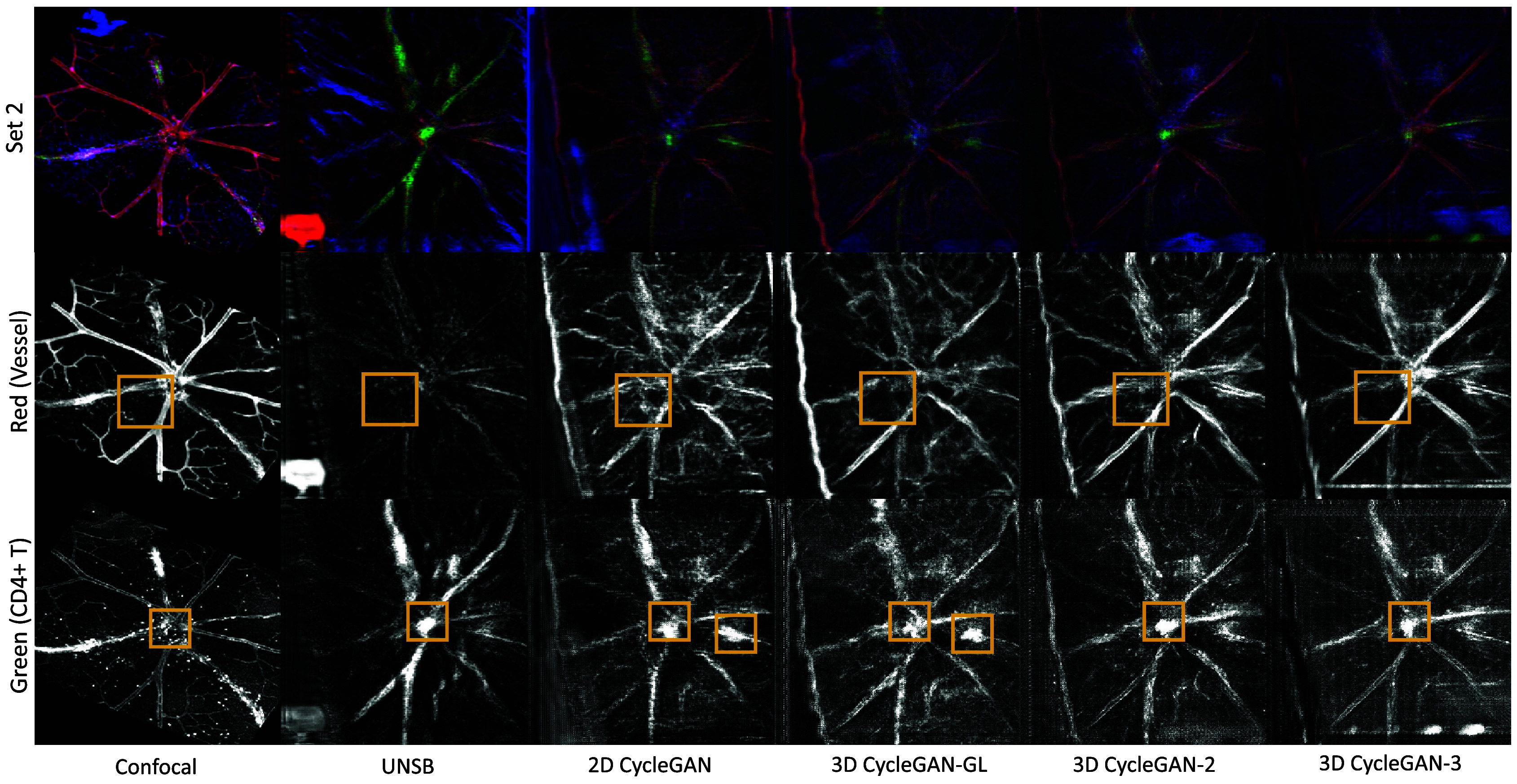 Figure 11.