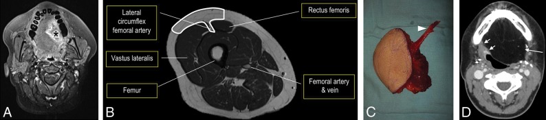 Fig 6.