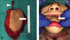 Fig 3.