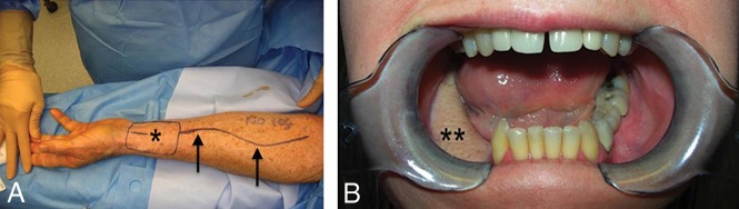 Fig 4.