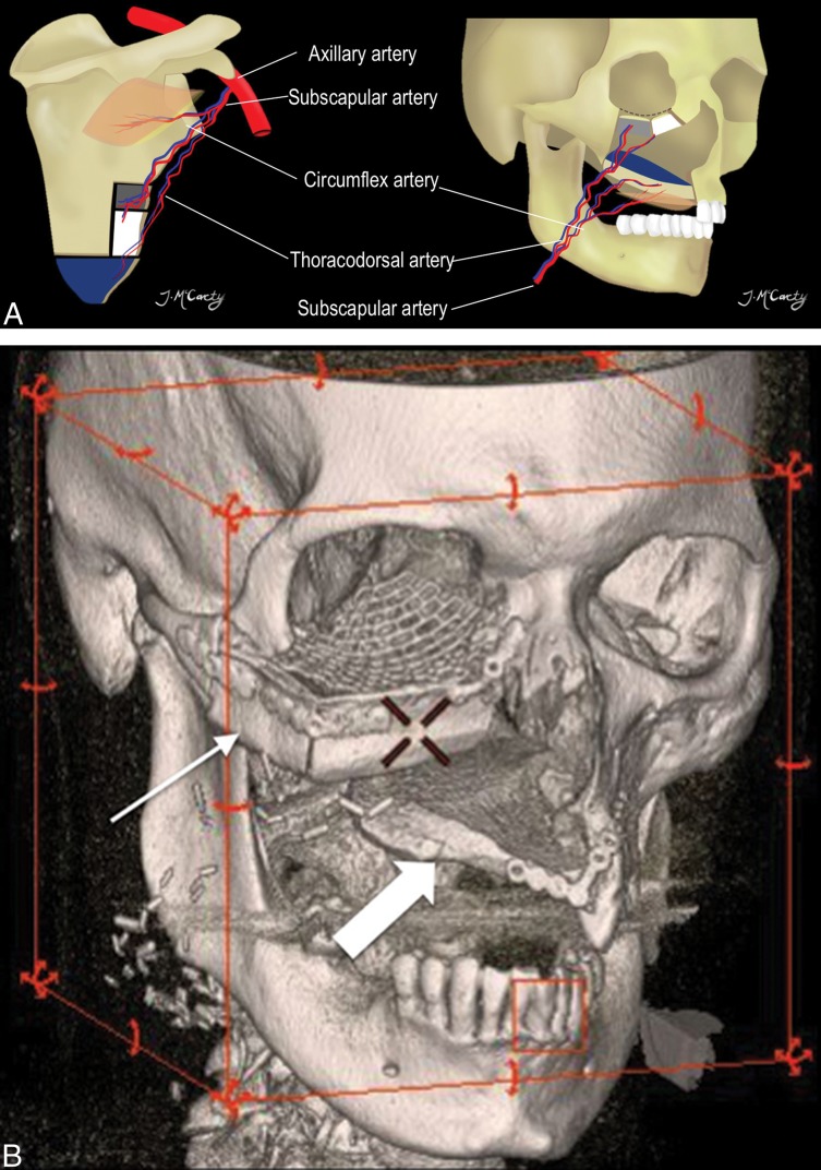 Fig 8.