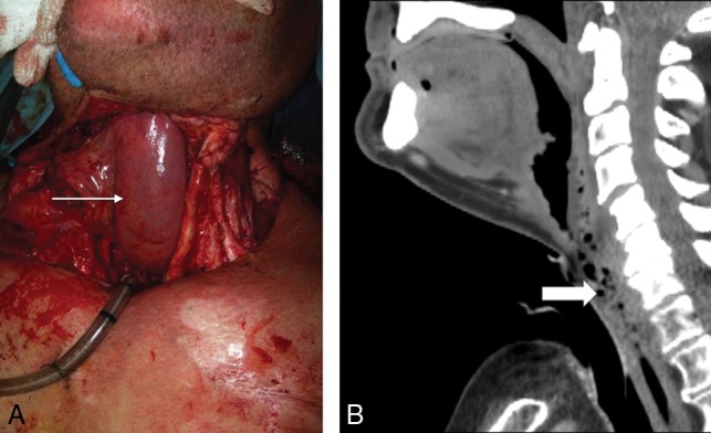 Fig 9.