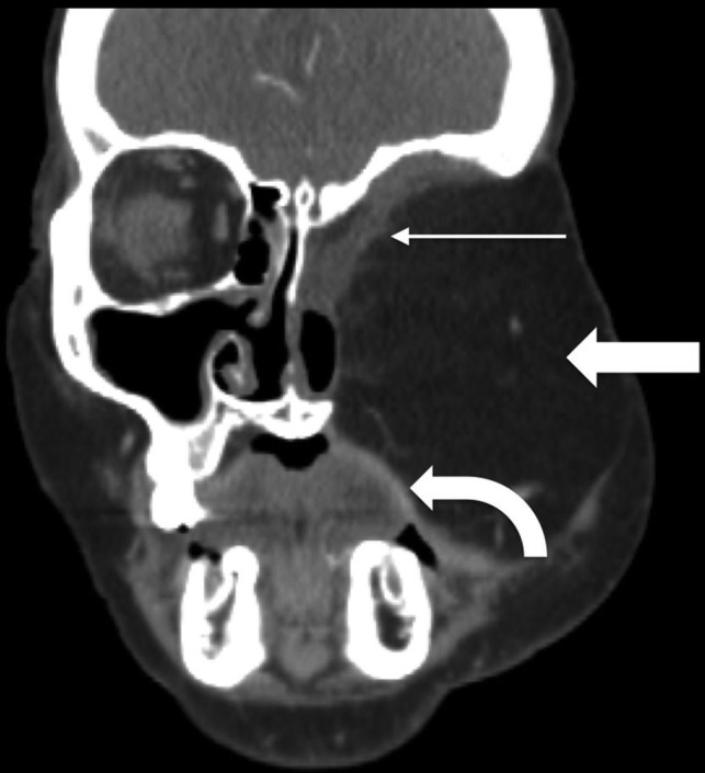 Fig 2.