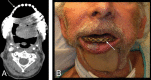 Fig 15.