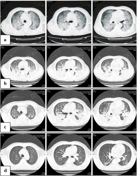 Fig. 2