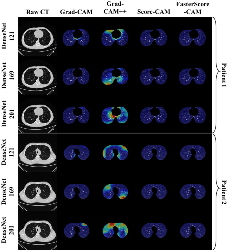 Figure 13