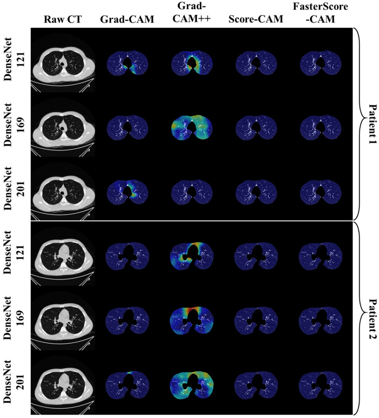 Figure 12