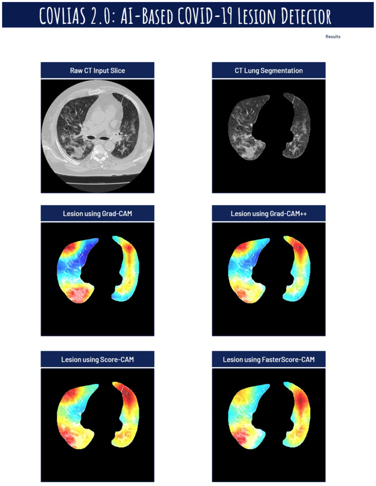 Figure 21