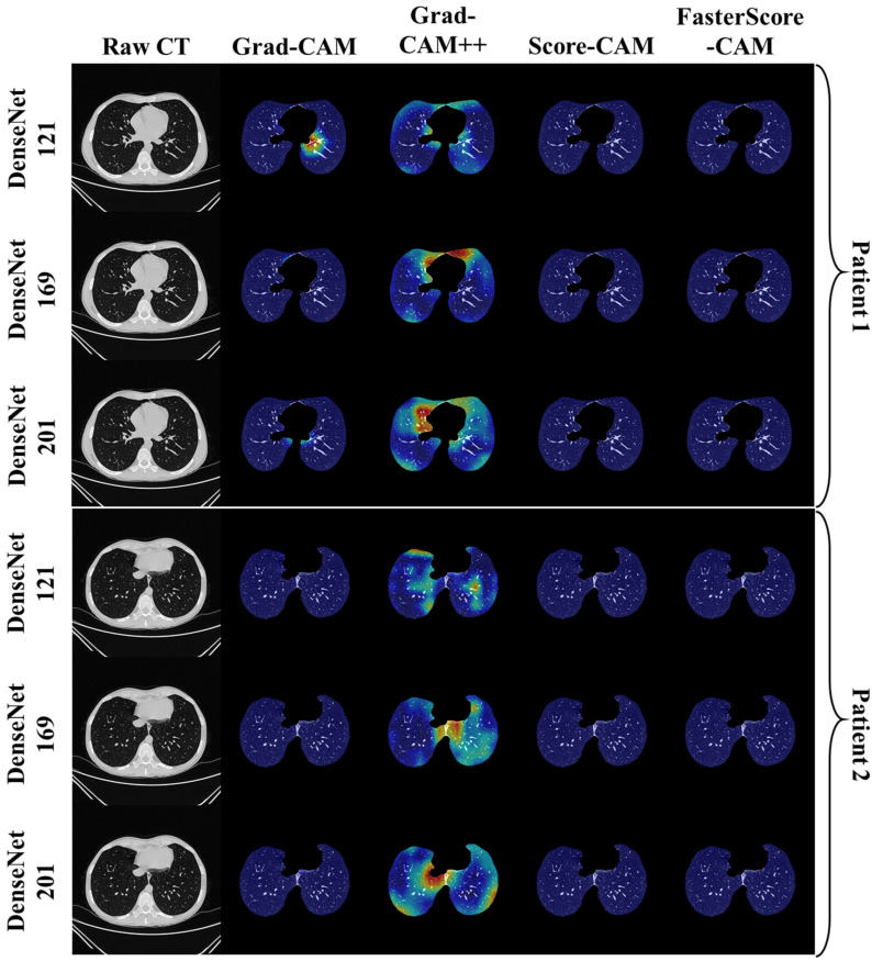 Figure 14