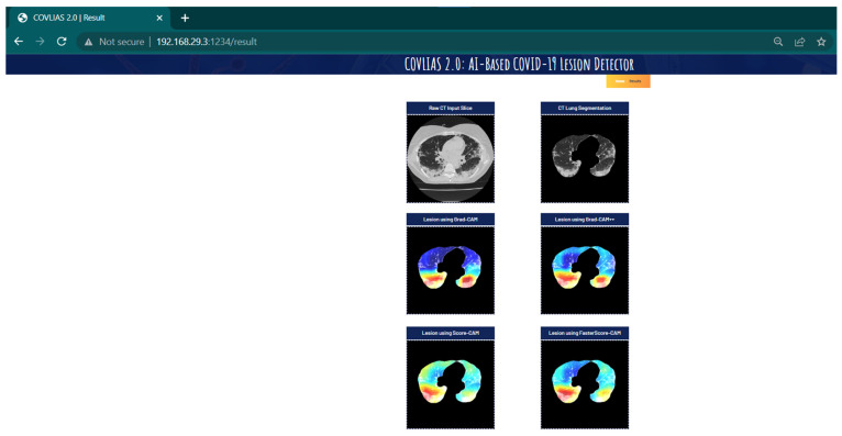 Figure 22