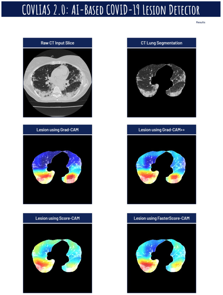 Figure 20