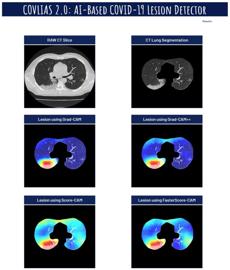 Figure 19