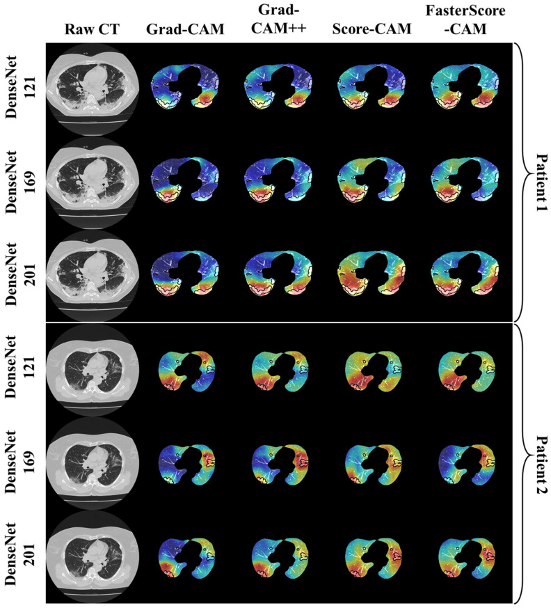 Figure 17