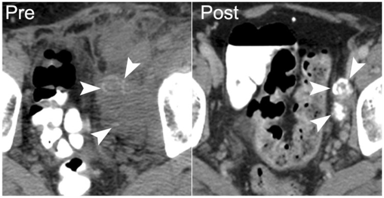 Figure 22