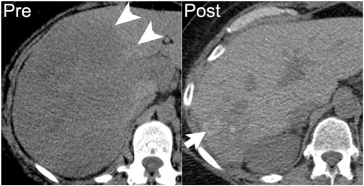 Figure 20