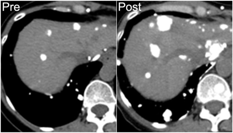 Figure 15