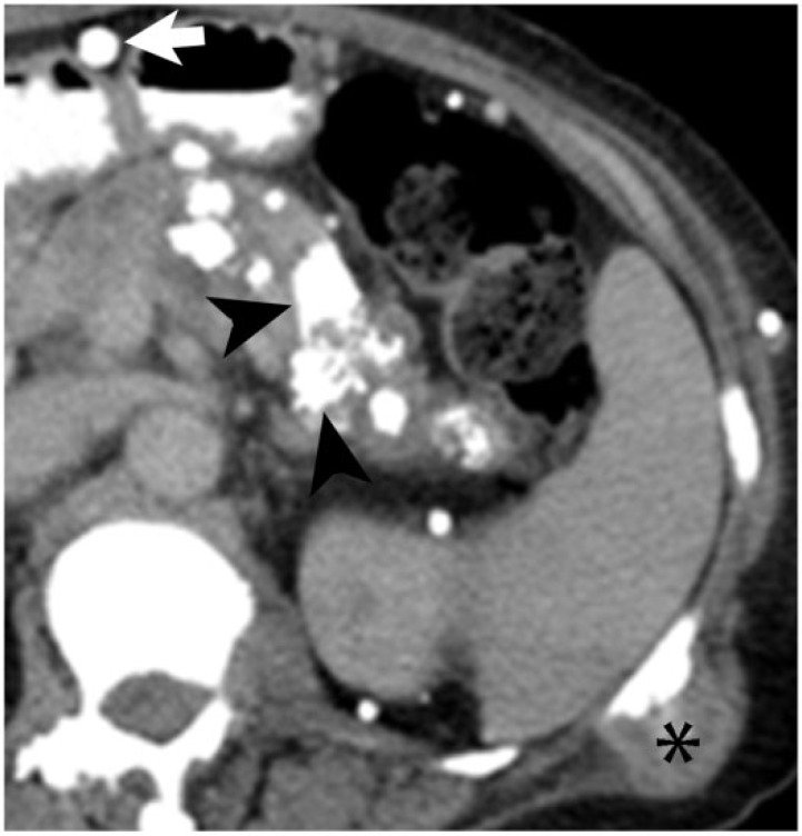 Figure 16