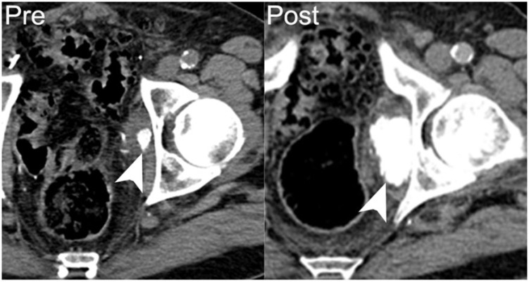 Figure 14