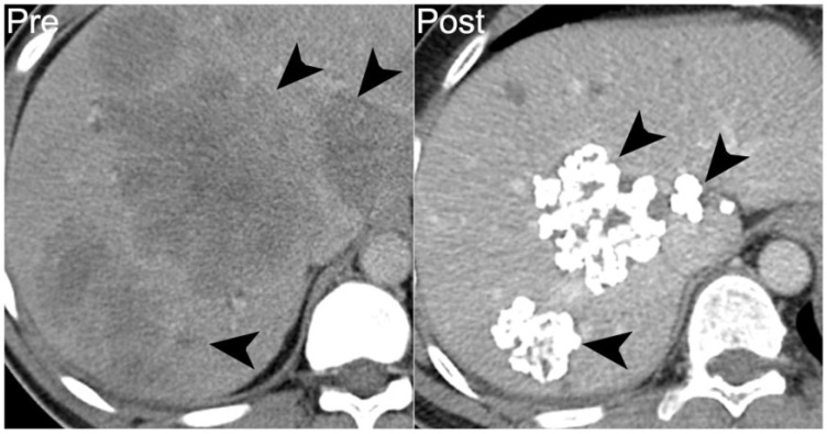 Figure 19