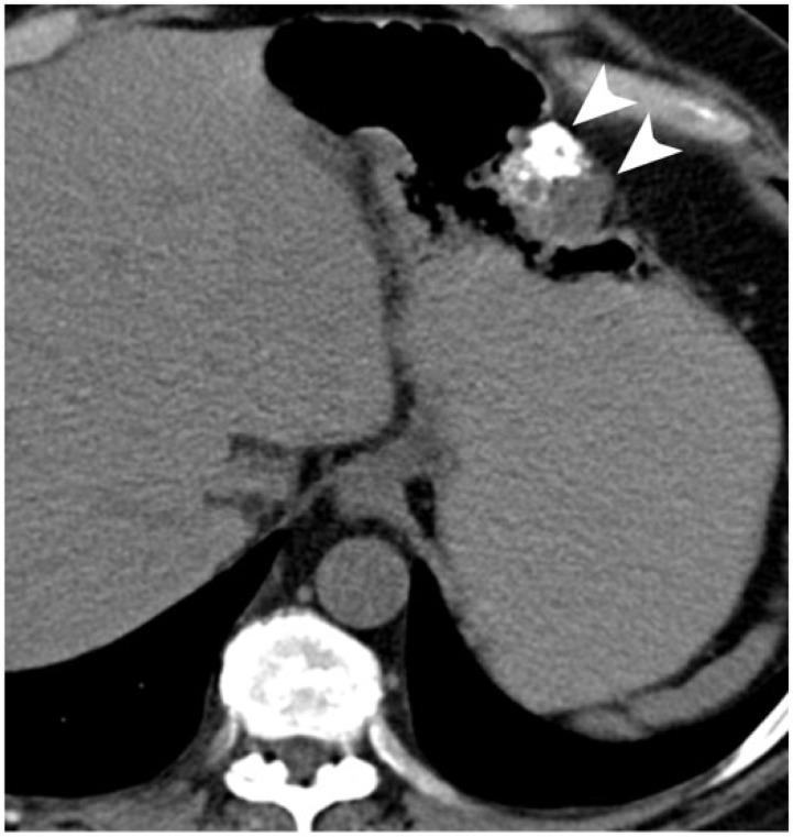 Figure 18