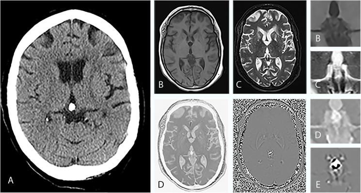 Fig 2