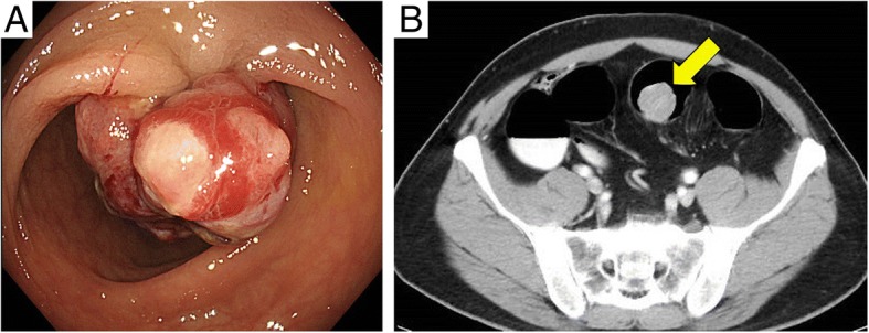 Fig. 1