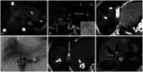 Fig. 9