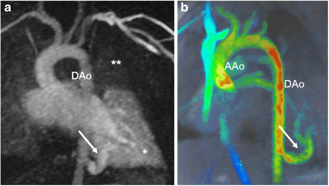 Fig. 12