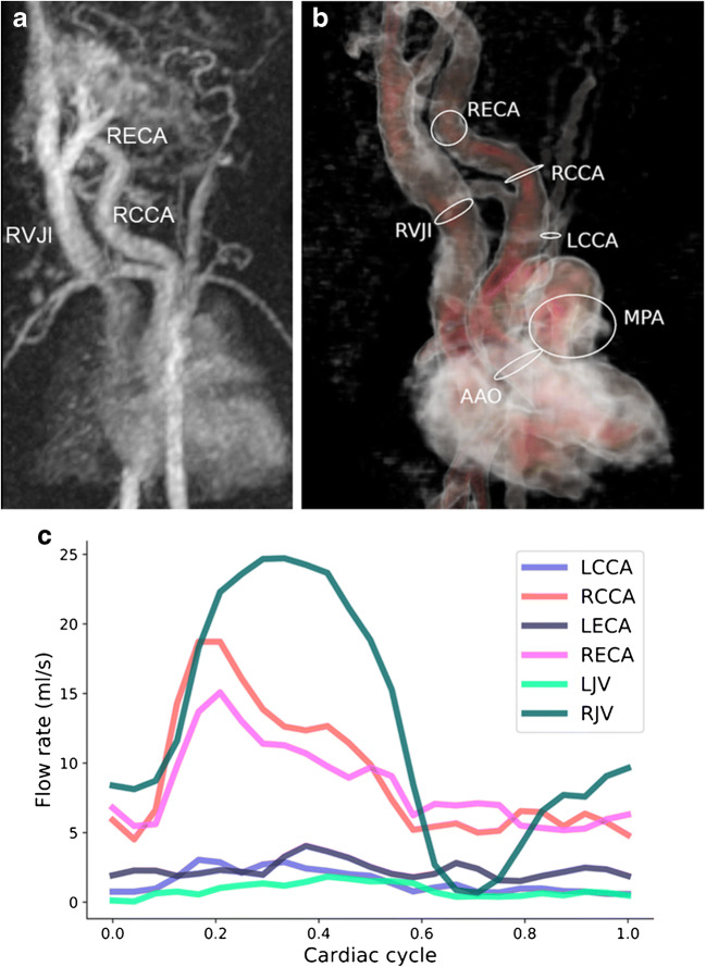 Fig. 13