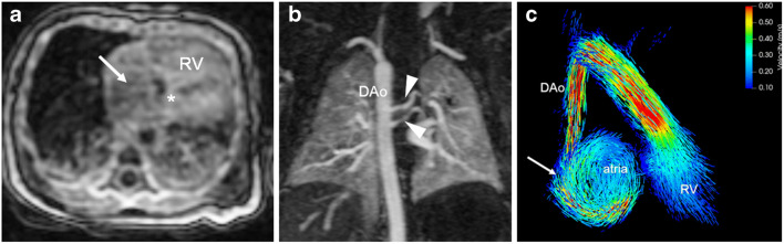 Fig. 11