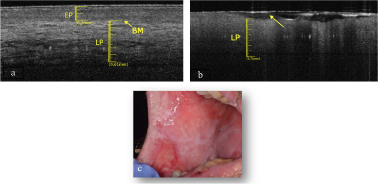 Fig. 10