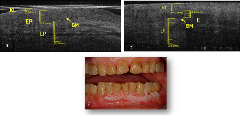 Fig. 11