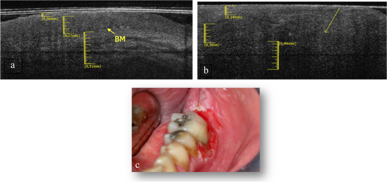 Fig. 12