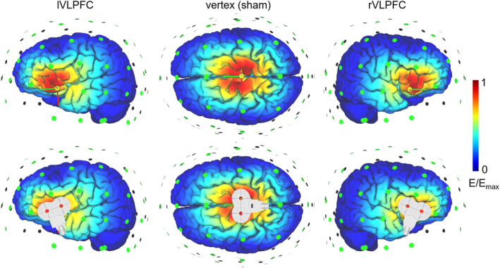 FIGURE 2