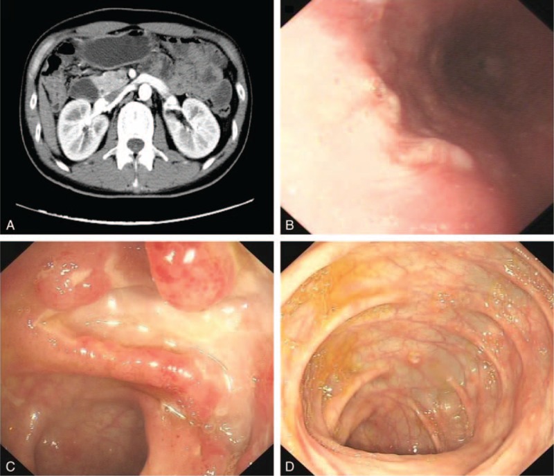 FIGURE 1