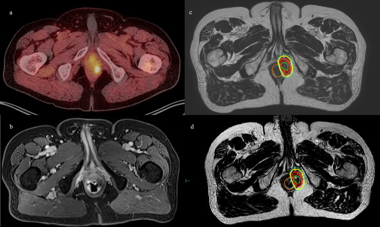 Figure 1