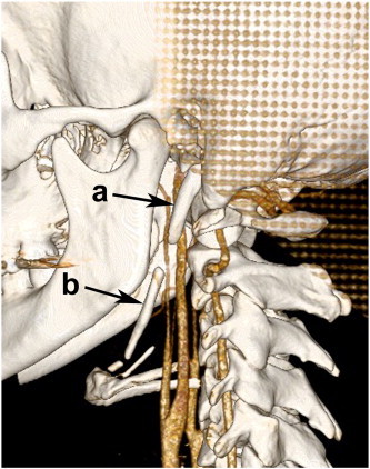 Fig 3