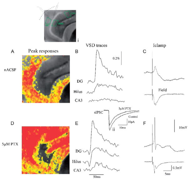 FIG. 1