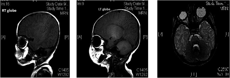 Fig. 2